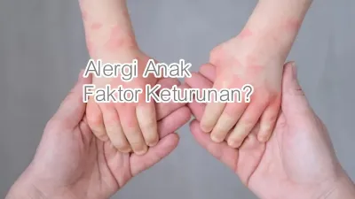 Alergi pada Anak Tidak Selalu Diturunkan Orang Tua, Ini Penjelasan Dokter