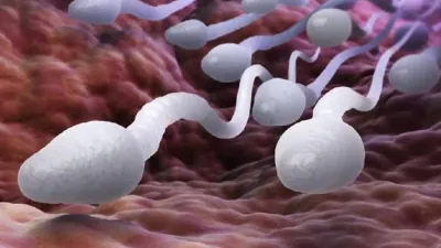 Kualitas Sperma Menurun? Ini Kebiasaan Sehari-hari yang Sering Tak Disadari Pria