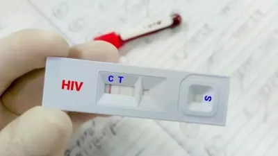 Deteksi Dini HIV Diperluas, Kemenkes Ajak Warga Segera Tes