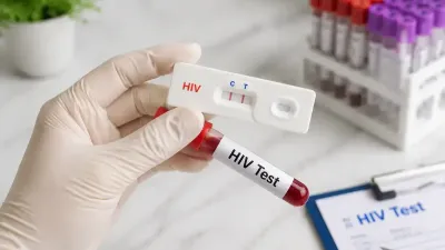 Program Skrining HIV Diperkuat, Kemenkes Verifikasi Data Sidoarjo
