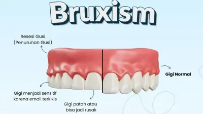 Bruxism Saat Tidur: Rahang Pegal dan Gigi Sensitif