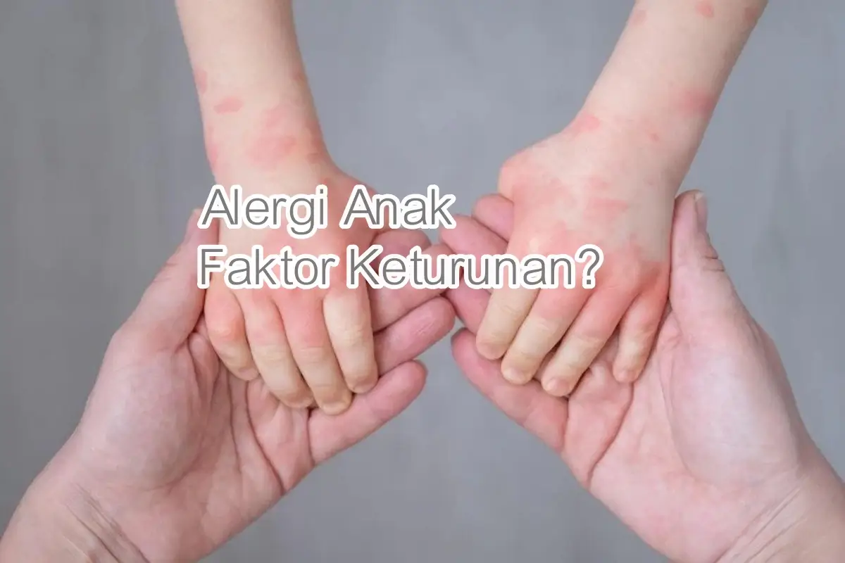 Alergi Anak Faktor Keturunan