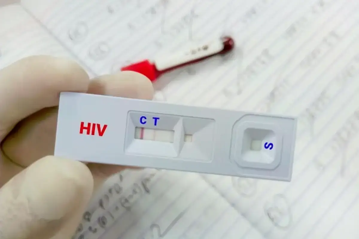 Deteksi Dini HIV Diperluas, Kemenkes Ajak Warga Segera Tes 1 Deteksi Dini HIV