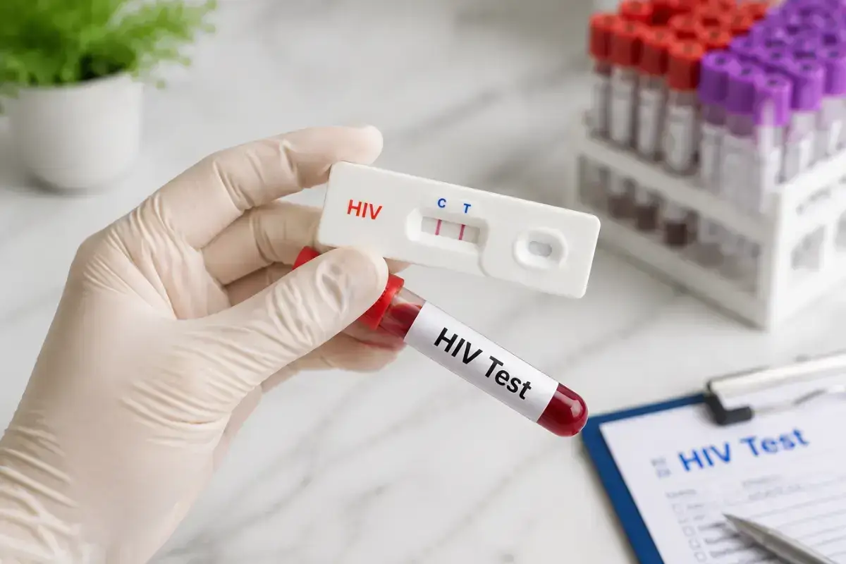 Program Skrining HIV